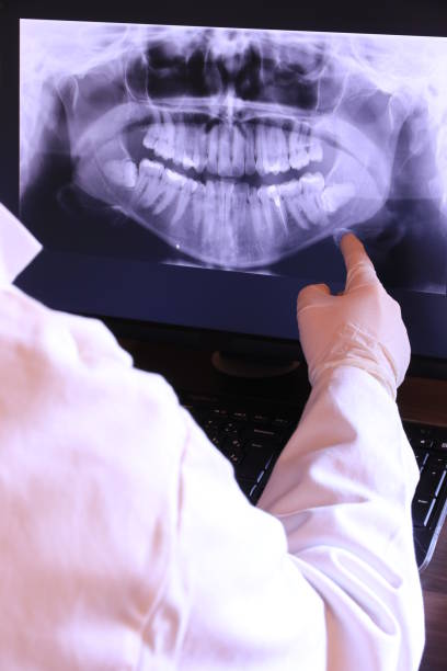 Best Emergency Dental Extractions in Willow Grove, TX
